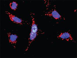 Anti-MKNK1 + PAK2 Antibody Pair