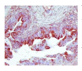 Anti-TIMP2 Rabbit Polyclonal Antibody