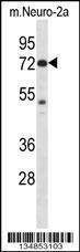 Anti-PAK4 Rabbit Polyclonal Antibody