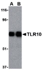 Anti-TLR10 Rabbit Polyclonal Antibody