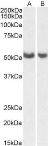 Anti-PTGIS Antibody (A85248) (0.5 µg/ml) staining of Human Lung (A) and Ovary (B) lysates (35 µg protein in RIPA buffer). Primary incubation was 1 hour. Detected by chemiluminescence