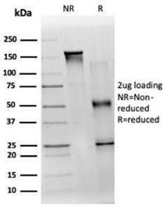 SDS-PAGE analysis of Anti-TDRKH Antibody [PCRP-TDRKH-1H2] under non-reduced and reduced conditions; showing intact IgG and intact heavy and light chains, respectively. SDS-PAGE analysis confirms the integrity and purity of the antibody