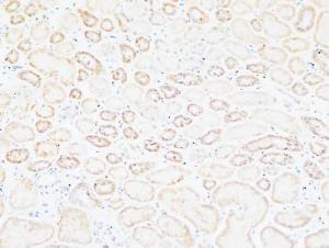 Anti-Tenascin C Rabbit Polyclonal Antibody