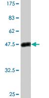 Anti-PSPH Mouse Monoclonal Antibody [clone: 3A5]