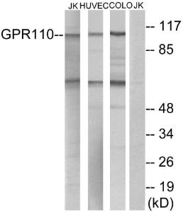 Western blot analysis of lysates from Jurkat, HUVEC, and COLO cells using Anti-GPR110 Antibody. The right hand lane represents a negative control, where the antibody is blocked by the immunising peptide