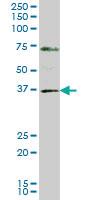 Anti-GBX2 Mouse Monoclonal Antibody [clone: 2D8]