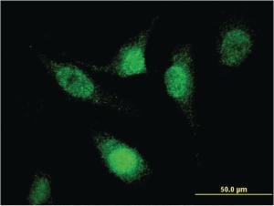 Anti-SREK1 Mouse Monoclonal Antibody [clone: 1D11]