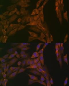 Immunofluorescence analysis of NIH-3T3 cells using Anti-PP2A-alpha + PPP2CB Antibody [ARC1889] (A309172) at a dilution of 1:100 (40x lens) DAPI was used to stain the cell nuclei (blue)