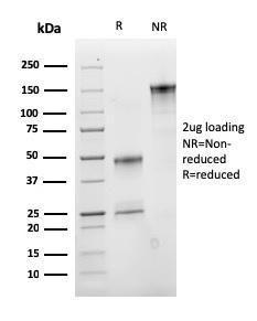 Antibody anti-IGF1 M23 bside 100 µg