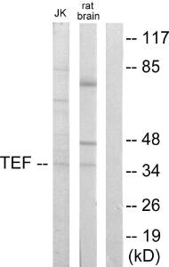 Western blot analysis of lysates from Jurkat and rat brain cells using Anti-TEF Antibody. The right hand lane represents a negative control, where the antibody is blocked by the immunising peptide