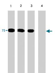 Anti-PAK6 Rabbit Polyclonal Antibody