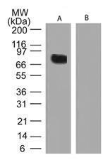 Anti-TGM2 Rabbit Polyclonal Antibody