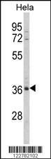 Anti-MDFIC Rabbit Polyclonal Antibody (APC (Allophycocyanin))