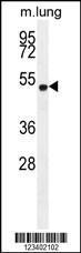 Anti-ELL Rabbit Polyclonal Antibody (AP (Alkaline Phosphatase))