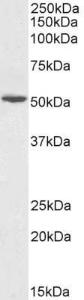 Anti-GPT Antibody (A85249) (0.1 µg/ml) staining of Human Liver lysate (35 µg protein in RIPA buffer). Primary incubation was 1 hour. Detected by chemiluminescence