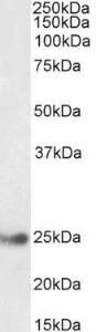 Anti-GSTA4 Antibody (A85250) (0.3 µg/ml) staining of Human Liver lysate (35 µg protein in RIPA buffer). Primary incubation was 1 hour. Detected by chemiluminescence