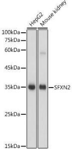 Western blot analysis of extracts of various cell lines, using Anti-SFXN2 Antibody (A306267) at 1:1000 dilution. The secondary Antibody was Goat Anti-Rabbit IgG H&L Antibody (HRP) at 1:10000 dilution. Lysates/proteins were present at 25 µg per lane