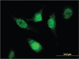 Anti-SREK1 Mouse Monoclonal Antibody [clone: 1D11]