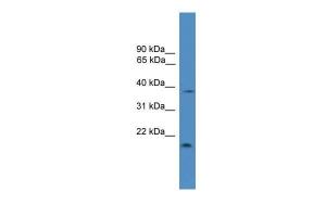 Anti-TIMP3 Rabbit Polyclonal Antibody