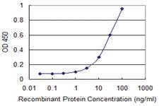 Anti-NIT1 Mouse Monoclonal Antibody [clone: 1C3]