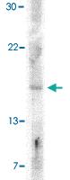 Anti-IFNB1 Rabbit Polyclonal Antibody