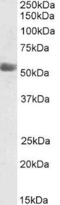 Anti-KMO Antibody (A85251) (0.03µg/ml) staining of Human Placenta lysate (35µg protein in RIPA buffer). Primary incubation was 1 hour. Detected by chemiluminescence.