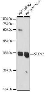 Western blot analysis of extracts of various cell lines, using Anti-SFXN2 Antibody (A306267) at 1:1000 dilution. The secondary Antibody was Goat Anti-Rabbit IgG H&L Antibody (HRP) at 1:10000 dilution. Lysates/proteins were present at 25 µg per lane