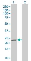 Anti-MND1 Mouse Polyclonal Antibody