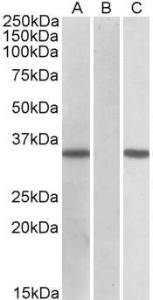 HEK293 lysate (10ug protein in RIPA buffer) overexpressing Human CRISP2 (RC205312) with C-terminal MYC tag probed with Anti-CRISP2 Antibody (A83604)