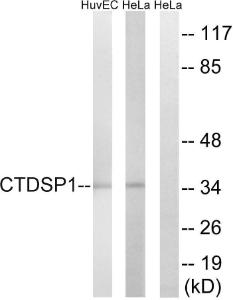 Anti-CTDSP1 Rabbit Polyclonal Antibody