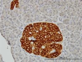 Anti-RAB3B Mouse Monoclonal Antibody [clone: 3F12]