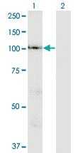 Anti-VPS41 Mouse Polyclonal Antibody