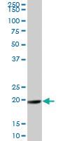 Anti-MND1 Mouse Polyclonal Antibody