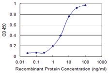 Anti-SREK1 Mouse Monoclonal Antibody [clone: 1D11]