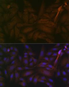 Immunofluorescence analysis of U-2 OS cells using Anti-PP2A-alpha + PPP2CB Antibody [ARC1889] (A309172) at a dilution of 1:100 (40x lens) DAPI was used to stain the cell nuclei (blue)