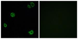 Immunofluorescence analysis of A549 cells using Anti-GPR110 Antibody. The right hand panel represents a negative control, where the antibody was pre-incubated with the immunising peptide