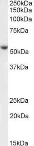 Anti-KMO Antibody (A85252) (1µg/ml) staining of Human Placenta lysate (35µg protein in RIPA buffer). Primary incubation was 1 hour. Detected by chemiluminescence.