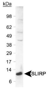 Anti-SLIRP Rabbit Polyclonal Antibody