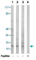 Anti-CHP2 Rabbit Polyclonal Antibody