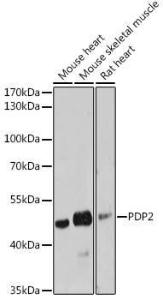 Western blot analysis of extracts of various cell lines, using Anti-PDP2 Antibody (A93290) at 1:3,000 dilution