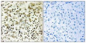 Anti-CTDSP1 Rabbit Polyclonal Antibody