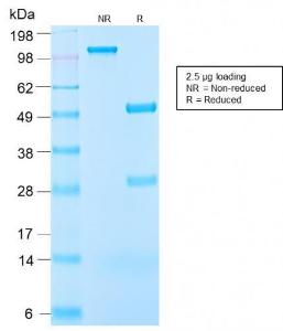 SDS-PAGE analysis of Anti-IGF1 Antibody [IGF1/2872R] under non-reduced and reduced conditions; showing intact IgG and intact heavy and light chains, respectively. SDS-PAGE analysis confirms the integrity and purity of the antibody.