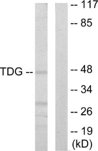 Western blot analysis of lysates from Jurkat cells using Anti-TDG Antibody. The right hand lane represents a negative control, where the antibody is blocked by the immunising peptide.