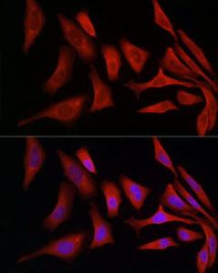 Immunofluorescence analysis of HeLa cells using Anti-ERp72 Antibody (A9438) at a dilution of 1:50 (40x lens). DAPI was used to stain the cell nuclei (blue).