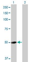 Anti-GC Rabbit Polyclonal Antibody