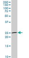 Anti-NKX3-1 Mouse Monoclonal Antibody [clone: 1C7]