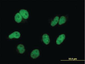 Anti-CAND1 Mouse Monoclonal Antibody [clone: 4D10]