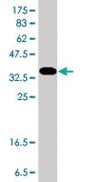 Anti-TGFBI Mouse Polyclonal Antibody