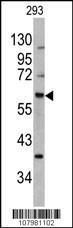 Anti-MDM2 Rabbit Polyclonal Antibody (FITC (Fluorescein))