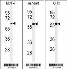 Anti-PAPD4 Rabbit Polyclonal Antibody (Biotin)